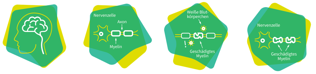 MS und ich: Grafik „Zentrales Nervensystem“