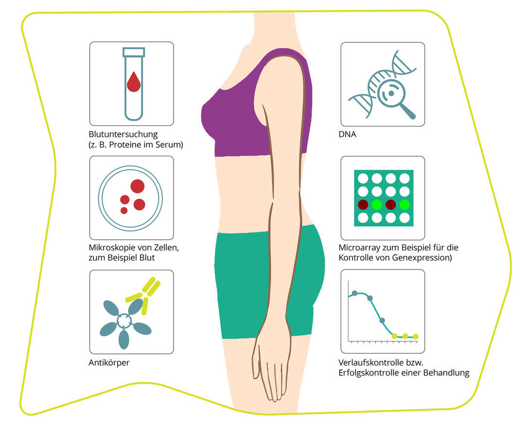 Biomarker-Analysen: Methoden zur Überwachung und Individualisierung der MS-Therapie  Grafische Darstellung eines menschlichen Körpers mit Symbolen, die verschiedene Methoden zur Analyse von Biomarkern zeigen. (Enthalten sind Symbole für Blutuntersuchung, Mikroskopie von Zellen, Antikörper, DNA-Analyse, Microarrays zur Kontrolle von Genexpression und Verlaufskontrolle einer Behandlung.)
